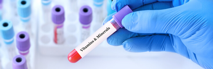 Doctor holding a test blood sample tube with Vitamins and Minerals test on the background of...