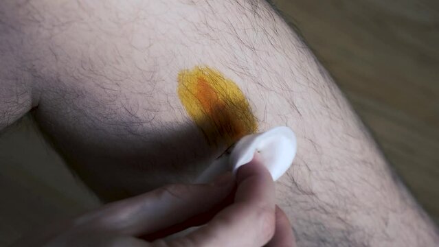A man treats a wounded leg with medical iodine and applies an elastic bandage. Medical topics. Close-up. 4k video
