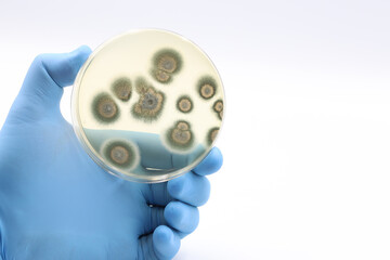 Fungal colonies isolated in the scientific research laboratory on a Petri dish