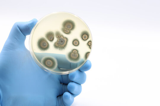 Fungal colonies isolated in the scientific research laboratory on a Petri dish