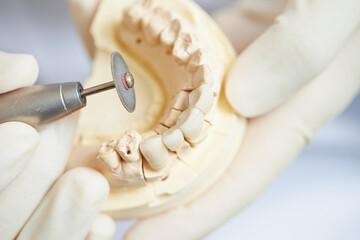 Dentures being trimmed with a dental drill piece	