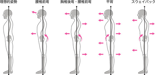立ち姿勢評価分類