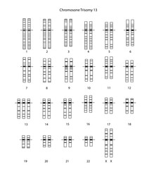 Chromosome Trisomy 13