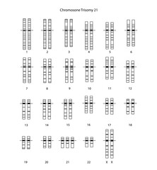 Chromosome Trisomy 21