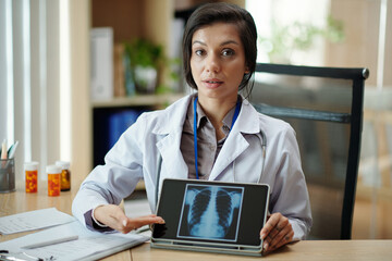 Portrait of radiologist showing chest x-ray to client