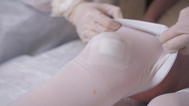 Close-up A nurse in sterile gloves puts a compression stocking on the patient's leg after replacing a sterile patch on postoperative sutures.