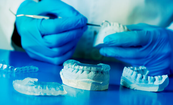 dentist adjusting an occlusal splint