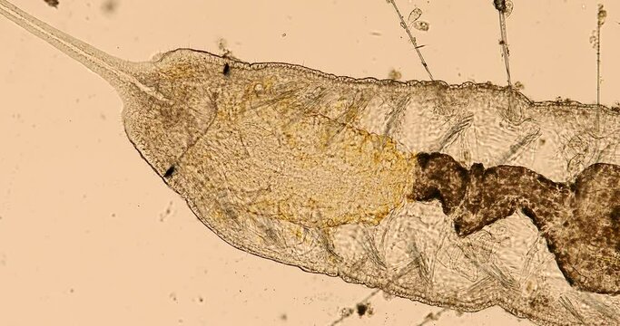 Stylaria lacustris (worm of the family Naididae) under the microscope - light microscope x100 magnification