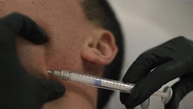 Close-up. Syringe with a needle for injection under the skin of the face of men, tightening procedure. White matter. Beautician's black gloves