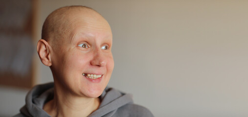 Effects of chemotherapy. Portrait of funny face millennial hairless woman having cancer diagnosis...