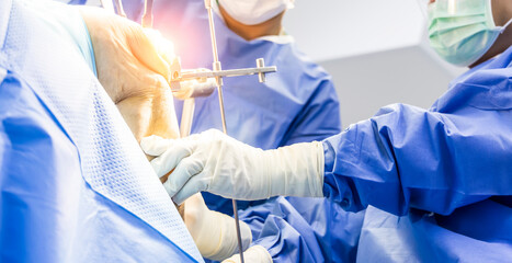 Hand of doctor or surgeon in blue gown inside operating room during osteomy in total knee joint...
