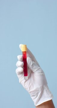 Vertical video of hand wearing medical glove holding blood sample on blue background, slow motion
