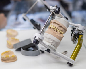 Plaster cast of the jaw in the articulator in the prosthetic workshop. 