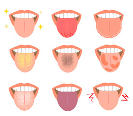 舌の症状から分かる体調不良　漢方治療