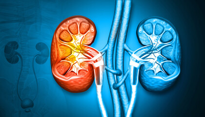 Human Kidney Disease. Medical organ. Cross section. 3d illustration