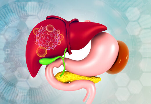 Liver cancer, human digestive system. 3d illustration.