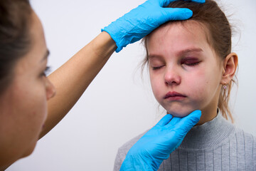 Doctor checking girl eye with bruise, close-up