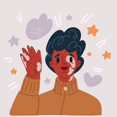 Vector illustration of vitiligo girl