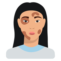 Woman with the skin disease vitiligo acceptance of your appearance avatar