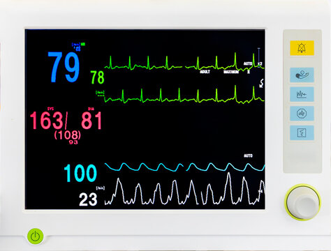 Medical vital sign monitor screen in operating room or hospital.Heart rate or blood pressure was recorded.Normal oxygen level. EKG graph on black background.Colorful number shows hypertension. - Powered by Adobe