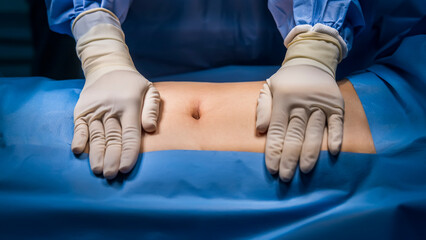 Abdomen prepare for abdominal surgery with sterile drape.Surgeon or nurse in blue uniform put hands with glove on patient.Abdominal surgery inside operating room in hospital.Hernia repair surgery. - obrazy, fototapety, plakaty