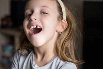 beautiful little girl of 6-7 years old lost the first milk tooth. Loss of primary teeth, replacement of teeth with permanent ones. Children's dentistry. Beautiful child teeth