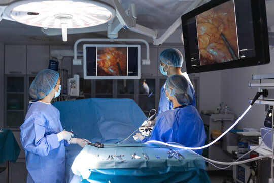 Three surgeons doing laparoscopic surgery. Doctors looking at image on monitor. Medicine and healthcare concept. Internal organ of patient seen on computer monitor