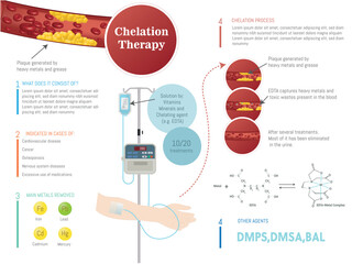 Infographic: Elimination of heavy metals and toxins in the blood by chelation treatment, explanation of the treatment in graphic form. - obrazy, fototapety, plakaty
