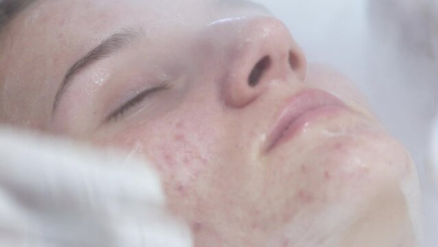 Close up portrait of young woman with eyes closed having thermal steam treatment on face. Acne problems treatment