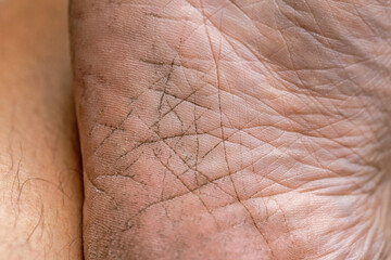 Naklejka premium Dirty smelly and dirty feet