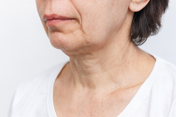 The lower part of elderly woman's face and neck with signs of skin aging on a white background....