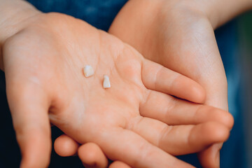 An image from a close angle of small children's hands holding two tiny baby teeth. The concept of pediatric dentistry.