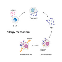 Allergy mechanism. Anaphylactic reaction, allergic reaction, Autoimmune disorders, allergy and anaphylaxis. Mast cells, b cell, basophils and IgE antibodies are in involved in Anaphylactic reaction.. - obrazy, fototapety, plakaty