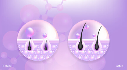 Hyaluronic acid before and after hair and skin solutions ad. purple collagen serum drop into skin cells with cosmetic advertising background ready to use, illustration vector.	