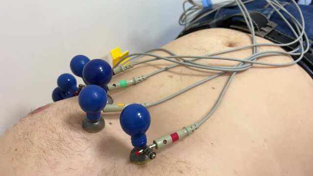 diagnoses heart disease cardiogram ECG or EKG of heart with electrodes for recording electrocardiogram on bed latest wireless cardiogram equipment chest of man lying inhospital for heart treatment