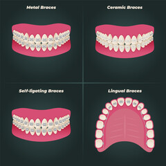 The concept of teeth alignment with braces. Orthodontic dentistry. The alignment of the teeth. Beautiful white teeth. Isolated flat vector illustration. Simple teeth in a row. Orthodontic treatment.