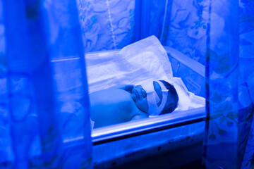 A newborn baby lies under ultraviolet lamps, under blue light. High bilirubin, treatment of childhood jaundice, ultraviolet incubator.