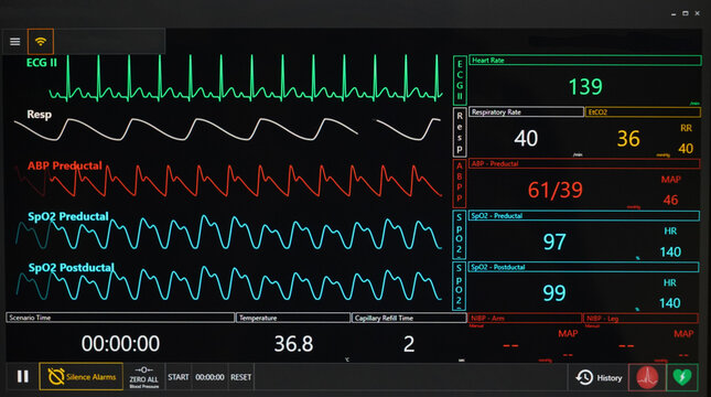 Control room of the pediatric resuscitation simulation course.
