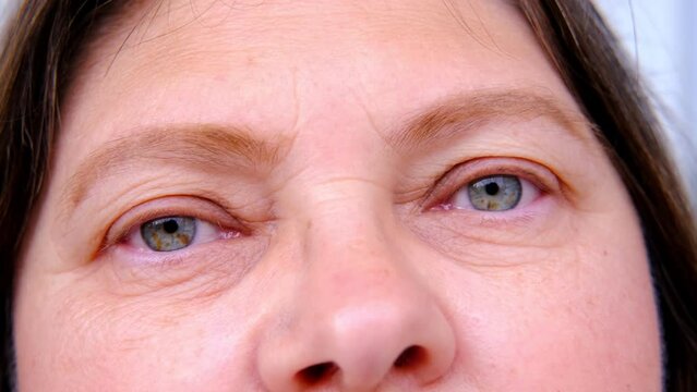 close up part of mature female face, woman 50-55 years old looks sad, deep wrinkles, age-related skin changes, wrinkles around eyes, concept of cosmetic anti-aging procedures, age crisis