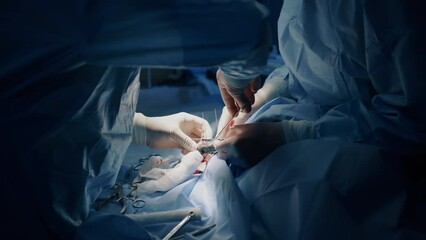 A closeup of a surgery performed by a veterinary and a assisted by a nurse. They are performing a surgery and need to be steady. High quality 4k footage. 