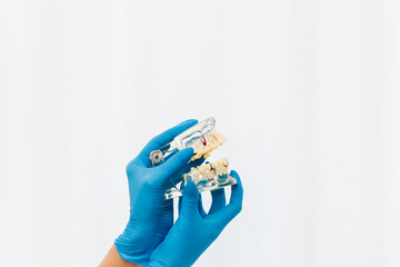 Dental demonstration model of the jaw in the hands of a surgeon.