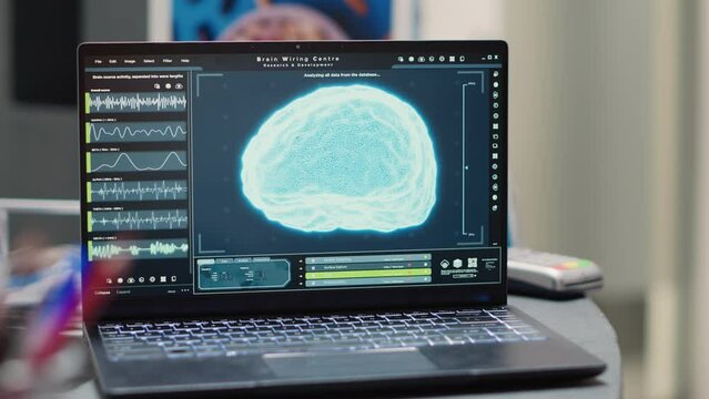 Laptop displaying human brain diagnosis on counter in empty hospital reception area, waiting room. Health care clinic showing tomography medical scan and neural system radiography. Close up.