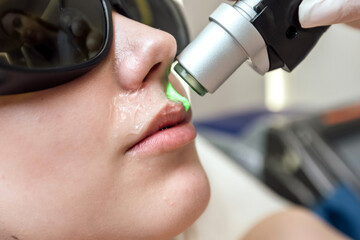 Epilation hair removal procedure on a womans body. Removing unwanted body hair.