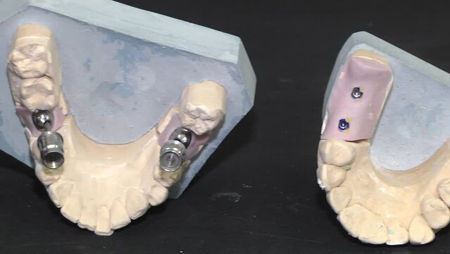 Work of a dental technician. Casts from the jaws of patients for the manufacture of prostheses. Prosthetic dentistry. Prosthesis on mini implants. Equipment for the orthodontist's office.