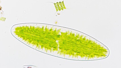 Netrium digitus, a green microalgae species belonging to the family Desmidiaceae. Live cell. 40x...