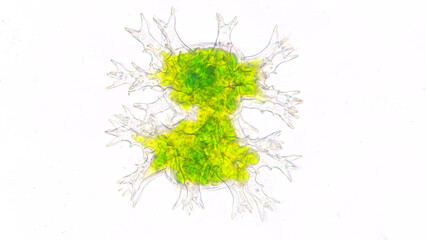 Staurastrum rotula, a microalgae with a lot of hand-like structure. Live cell. 40x objective lens....