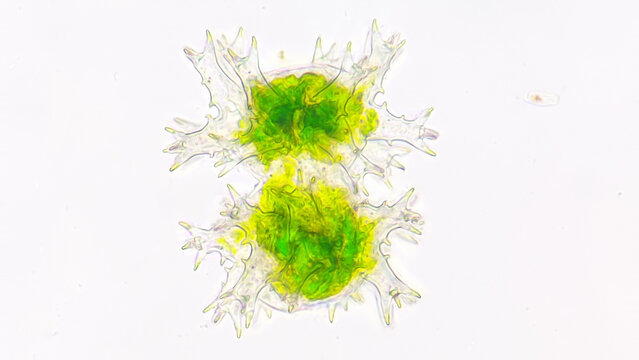 Staurastrum rotula, a microalgae with a lot of hand-like structure. Live cell. 40x objective lens. Selective focus
