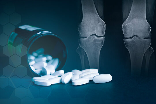 Glucosamine Chondroitin MSM is a drug for joints and ligaments. Dietary supplement to maintain joint health and prevent injuries of the articular-ligamentous apparatus, mixed media.