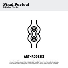 Arthrodesis joint surgery thin line icon. Arthritis. Pixel perfect, editable stroke. Vector illustration.