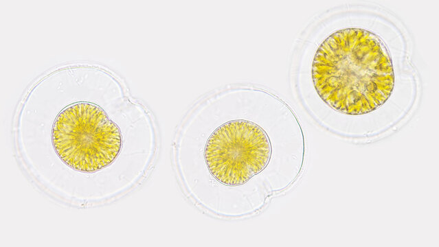 Marine phytoplankton, Pyrophacus sp. Marine dinoflagellate. 40x onjective lens. Selective focus
